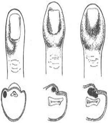 口是心非 视频海报