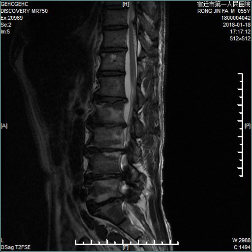 傀儡侦探 视频海报